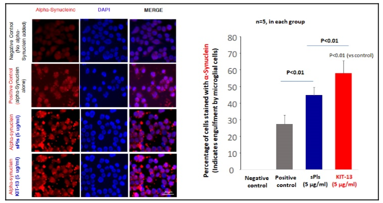 Drug Discovery for Neurodegenerative Diseases